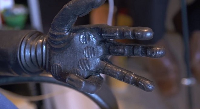 Người đàn ông đầu tiên trên thế giới sống với cánh tay robot điều khiển bằng trí não - Ảnh 4.