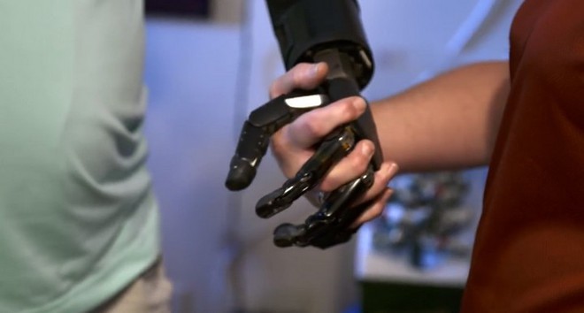 Người đàn ông đầu tiên trên thế giới sống với cánh tay robot điều khiển bằng trí não - Ảnh 5.