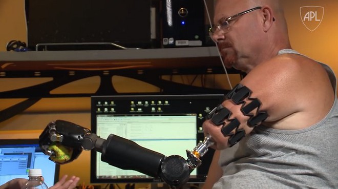 Người đàn ông đầu tiên trên thế giới sống với cánh tay robot điều khiển bằng trí não - Ảnh 7.