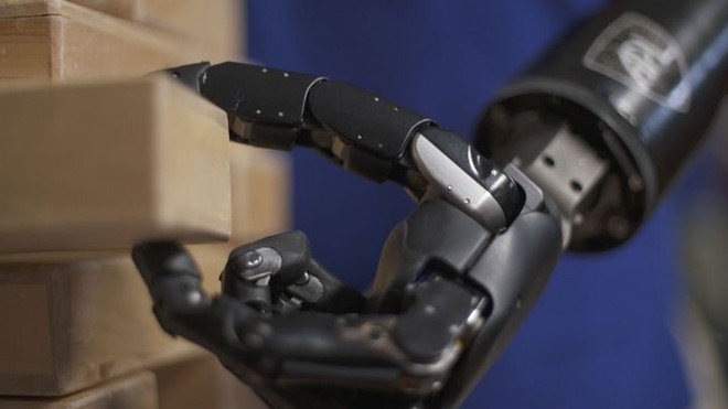 Người đàn ông đầu tiên trên thế giới sống với cánh tay robot điều khiển bằng trí não - Ảnh 8.