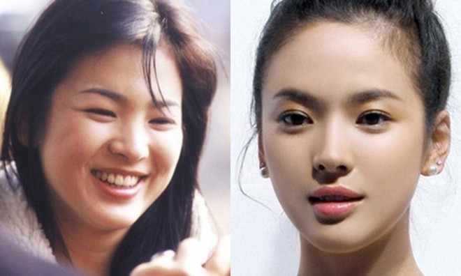 2 quốc bảo nhan sắc Hàn Quốc Song Hye Kyo và Son Ye Jin: Đều đẹp, siêu giàu, nhưng tình duyên lại quá khác biệt - Ảnh 3.