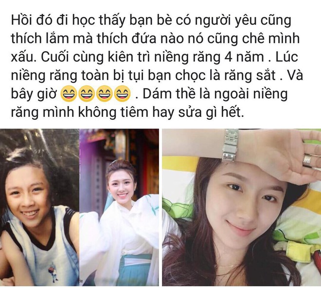 Một nụ cười thay đổi sau 4 năm, cô gái khiến người đối diện không ngừng xuýt xoa - Ảnh 1.