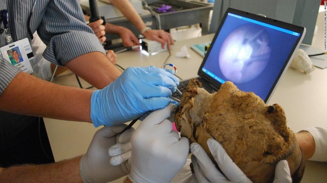 FBI bất ngờ tìm ra lời giải về bí ẩn xác ướp bị chặt đầu 4.000 năm tuổi - Ảnh 6.