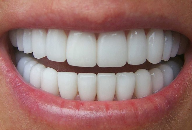 Bác sĩ BV Răng hàm mặt Trung ương chỉ rõ 3 biến chứng đáng sợ của răng sứ thẩm mỹ - Ảnh 2.
