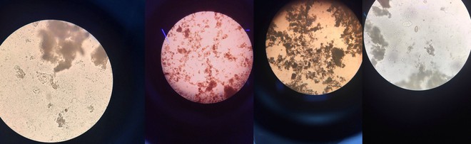 Loạt ảnh mặt Trăng được chia sẻ nhiều trên MXH thực chất là... phân dưới kính hiển vi - Ảnh 1.