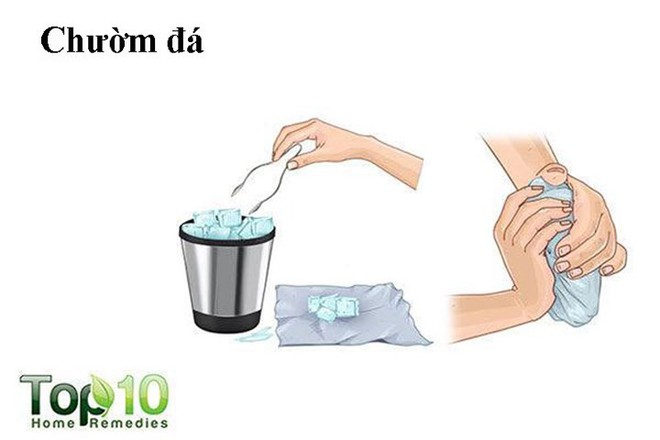Cách chữa bong gân ngón tay dễ dàng nhất - Ảnh 2.