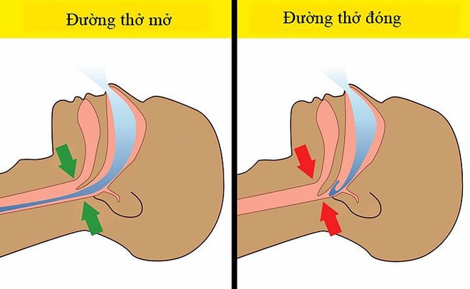 7 lý do khiến bạn thường xuyên bị tỉnh giấc ban đêm - Ảnh 3.