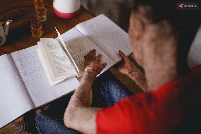 Chàng trai người cá lạc quan ở Hà Nội: Nhìn thấy bộ dạng của mình, nhiều người hỏi sao không chết đi, sống để làm gì? - Ảnh 13.