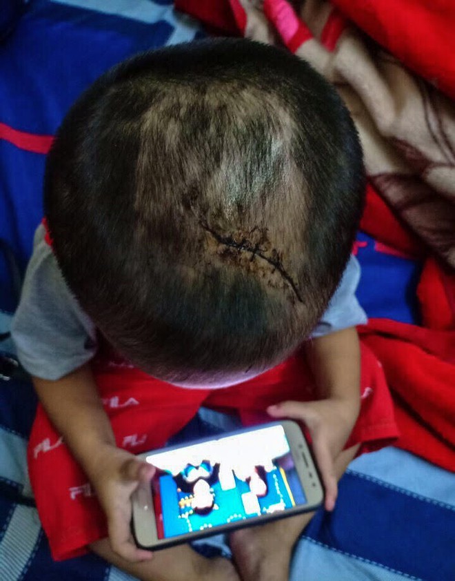 Những hình ảnh đau lòng của bé trai 3 tuổi nghi bị cha dượng bạo hành - Ảnh 3.