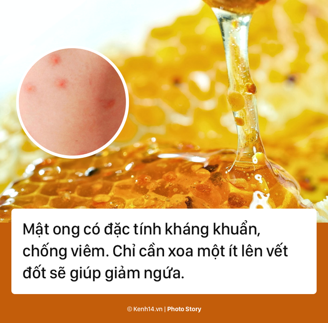 Giải quyết ngay vết muỗi đốt với các sản phẩm tự nhiên này - Ảnh 3.