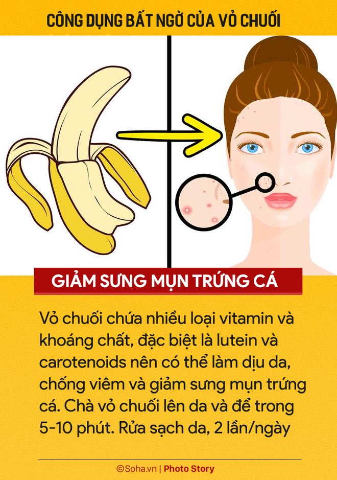 Ăn chuối hàng ngày nhưng ít người biết 7 công dụng từ vỏ chuối: Nhớ đừng vứt vào thùng rác - Ảnh 1.