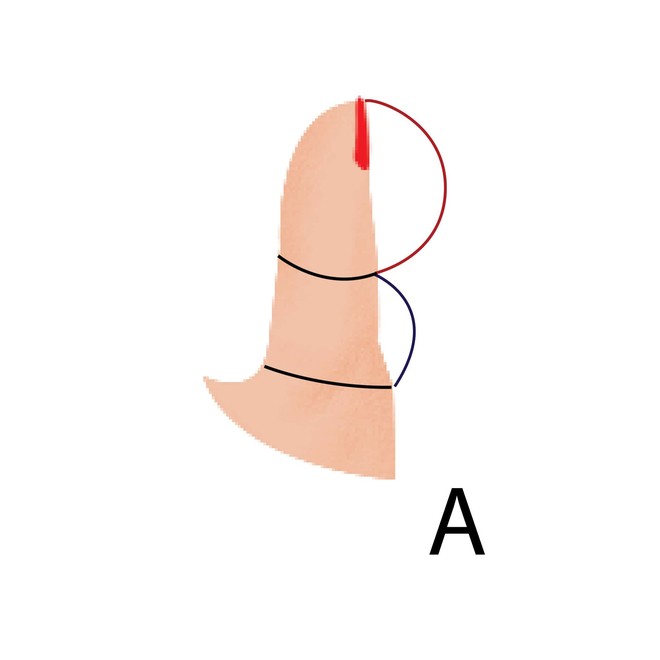 5 kiểu ngón tay cái và tính cách đi kèm, bạn là kiểu người nào? - Ảnh 1.