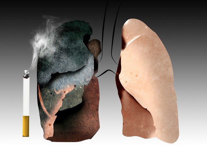 6 nhóm người có nguy cơ cao mắc ung thư phổi: 5 giải pháp phòng ngừa sớm giúp giảm tử vong - Ảnh 4.