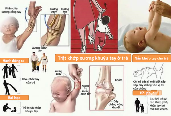 Cha mẹ còn cầm tay con theo kiểu này, đề phòng trật khớp tay con - Ảnh 2.