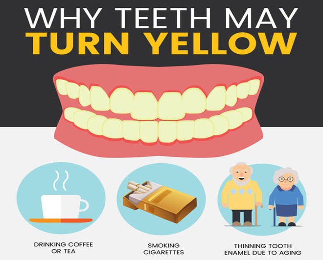 Tại sao răng của chúng ta bị ngả sang màu vàng? - Ảnh 1.