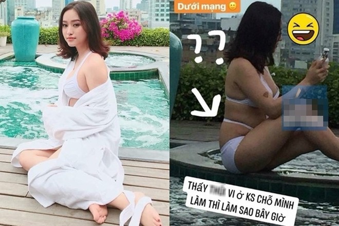 Nhan sắc hot girl Thúy Vi sau khi hút 2 kg mỡ bụng - Ảnh 2.