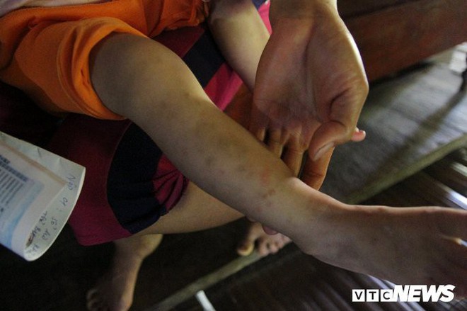 Nhiễm HIV ở Phú Thọ: Xót xa bé gái 18 tháng tuổi bỗng dưng nhiễm HIV - Ảnh 1.