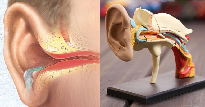 Chuyên gia tai mũi họng cảnh báo: Trẻ bị liệt mặt, điếc vì viêm tai giữa đang gia tăng - Ảnh 1.