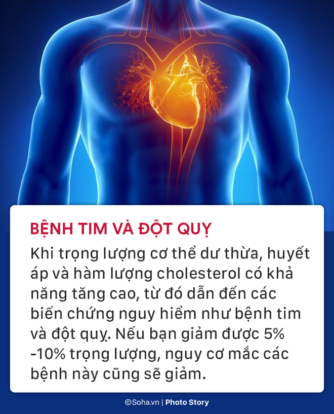 Bạn đã biết cách tính xem mình có bị béo phì và 7 căn bệnh nguy hiểm liên quan chưa? - Ảnh 2.