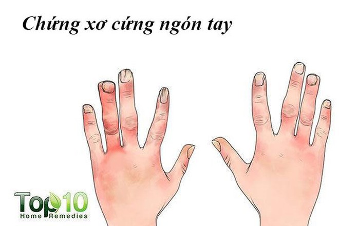 Các vấn đề về da liên quan đến bệnh tiểu đường thường gặp nhất - Ảnh 3.