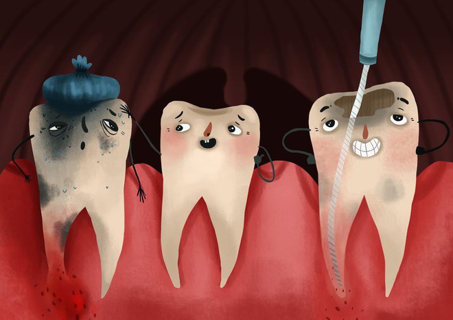 Bọc răng sứ không đảm bảo chất lượng, bạn phải đối mặt với những nguy cơ không ngờ - Ảnh 1.