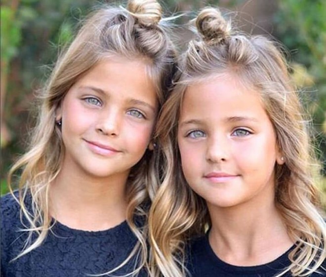 2 cô bé được gọi là cặp song sinh đẹp nhất thế giới nay đã lớn phổng phao, có một điều mãi không thay đổi - Ảnh 9.