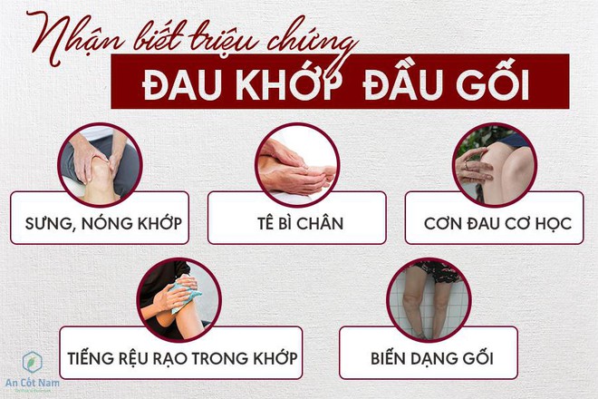 Đau khớp gối: Nguyên nhân, triệu chứng và cách điều trị đau đầu gối - Ảnh 1.