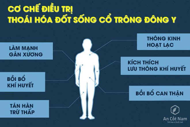 Thoái hóa đốt sống cổ: Nguyên nhân, triệu chứng và cách điều trị  - Ảnh 2.