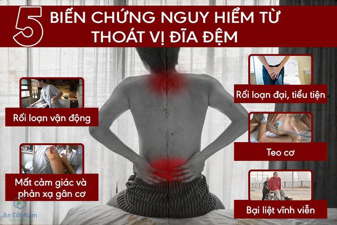 Mổ thoát vị đĩa đệm có chữa được tận gốc bệnh không và chi phí thế nào? - Ảnh 1.