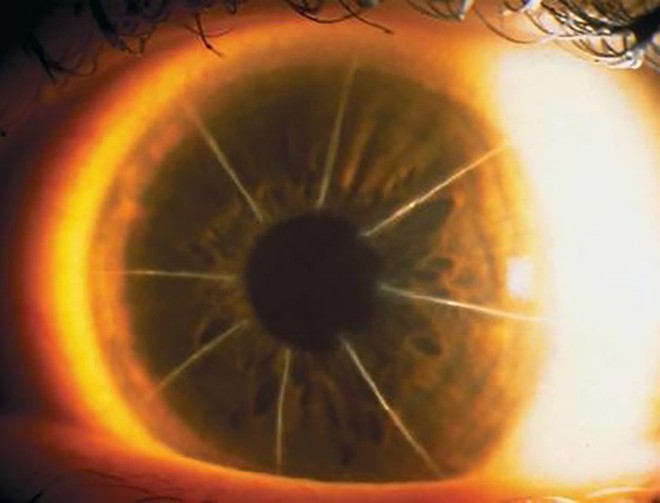 Bệnh nhân với con mắt siêu hiếm trông như bánh pizza 8 miếng: Minh chứng cho thấy y học đã từng đáng sợ như thế nào - Ảnh 4.