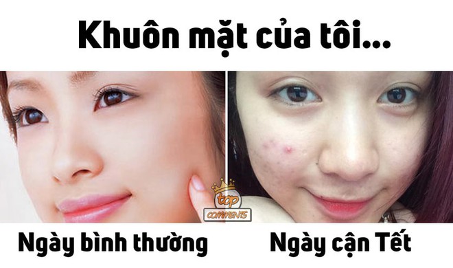 Có 1 kiểu người bình thường da luôn láng mịn nhưng cứ cận Tết là mụn lại rủ nhau về - Ảnh 1.