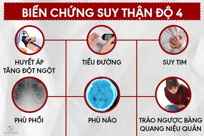 Suy thận độ 1, 2, 3, 4 và cách điều trị an toàn, hiệu quả - Ảnh 2.