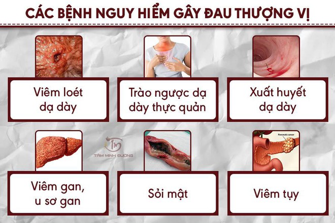 Đau thượng vị là gì? Nguyên nhân, triệu chứng và cách chữa trị - Ảnh 1.