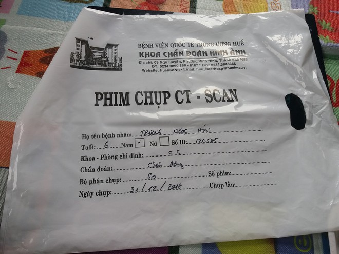 Vụ cô giáo tát học sinh lớp 1 nghi dẫn đến chấn động não: Cô giáo chỉ bị phê bình  - Ảnh 1.