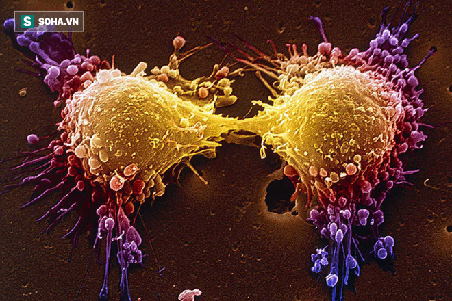 Cải thiện hệ miễn dịch là thuốc chống ung thư tốt nhất: Cơ thể sẽ tự tiêu diệt tế bào xấu - Ảnh 1.
