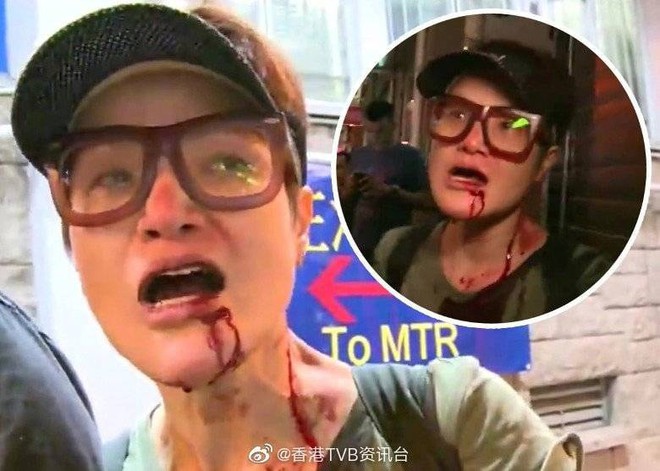 Nữ diễn viên nổi tiếng TVB bị người dân bức xúc, đánh trọng thương trên phố - Ảnh 1.