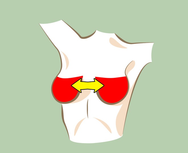 6 thay đổi hình dáng ngực bất thường: Đa phần là dấu hiệu cảnh báo bệnh ung thư - Ảnh 3.