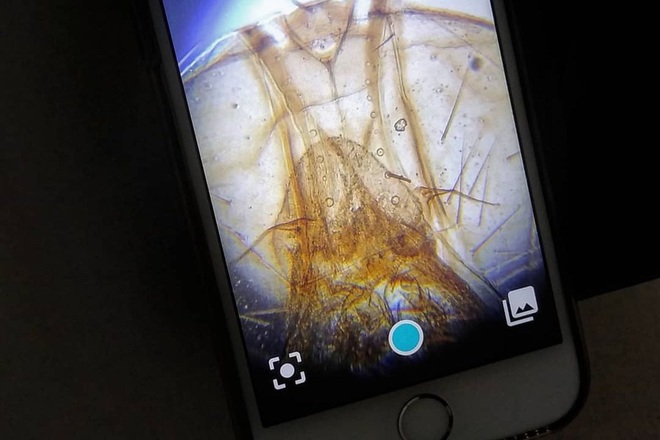 Phụ kiện độc đáo biến smartphone thành kính hiển vi, quan sát được cả vi khuẩn siêu nhỏ nhờ khả năng phóng đại gấp 1000 lần - Ảnh 5.