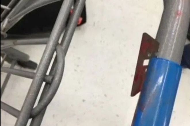 Đang đi mua sắm tại siêu thị, người phụ nữ bất ngờ bị một lưỡi dao cạo giấu trong tay cầm xe đẩy làm bị thương nghiêm trọng - Ảnh 2.