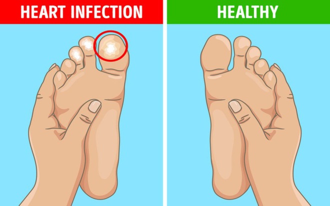 6 dấu hiệu bất thường ở chân cảnh báo bệnh nguy hiểm - Ảnh 4.