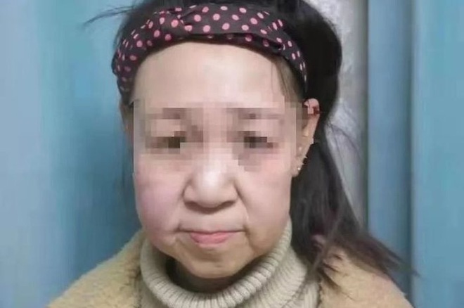 Thiếu nữ 15 tuổi bị gọi là quái vật vì gương mặt như bà lão 60 - Ảnh 2.