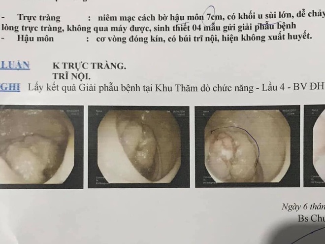 Chỉ một triệu chứng này, đi khám ra ung thư giai đoạn cuối - Ảnh 1.