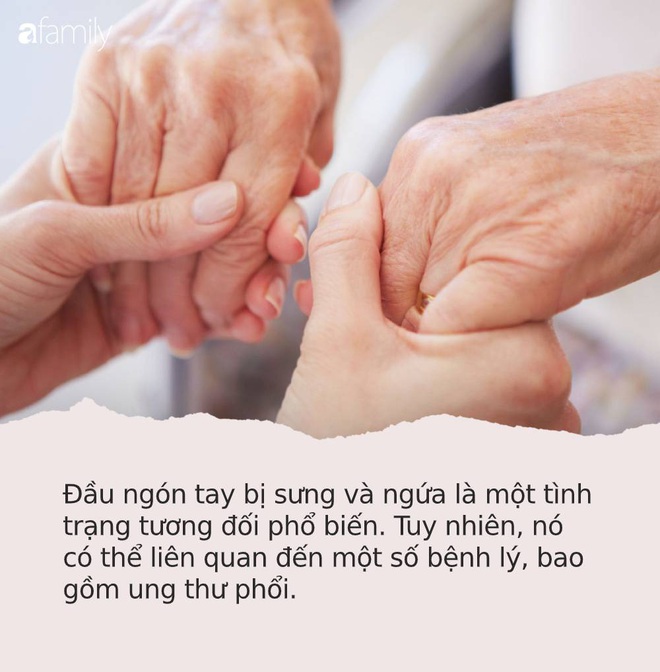 Những dấu hiệu nhìn là thấy của bệnh ung thư ác tính trên bàn tay và bàn chân mà rất nhiều người bỏ qua - Ảnh 1.