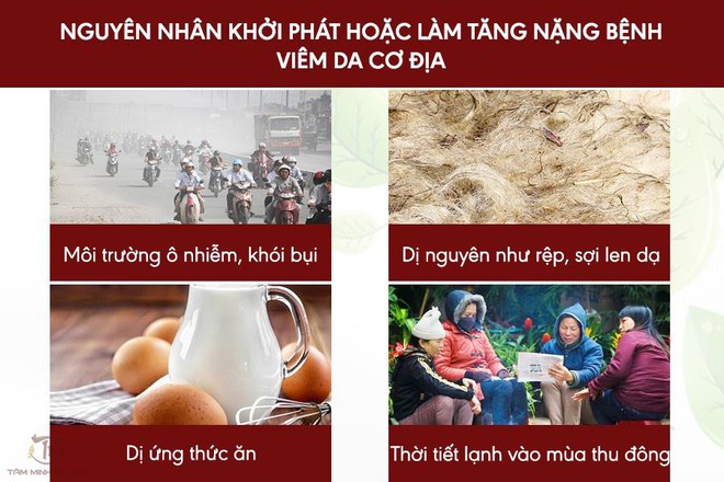 Viêm da cơ địa là gì? Nguyên nhân, triệu chứng và cách chữa bệnh hiệu quả - Ảnh 2.