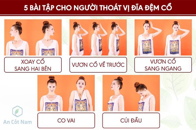 10 bài tập thoát vị đĩa đệm cổ - lưng tập đến đâu ngấm sâu đến đấy - Ảnh 1.