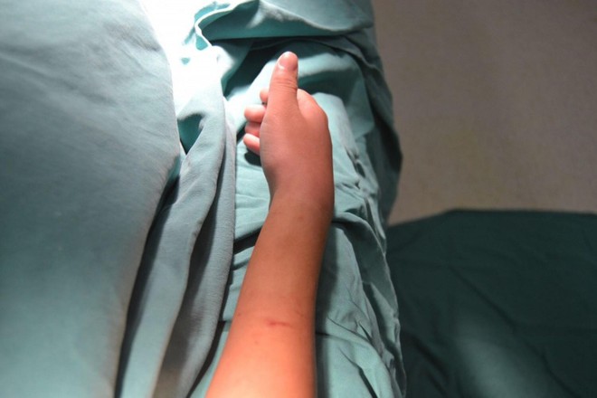 Bé trai 11 tuổi bị biến dạng cẳng tay sau một tháng đắp thuốc nam - Ảnh 1.