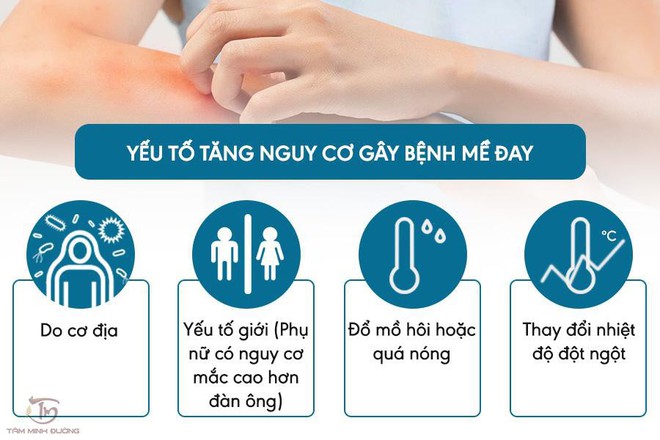 Bệnh nổi mề đay là gì? Nguyên nhân, triệu chứng và cách chữa hiệu quả - Ảnh 2.