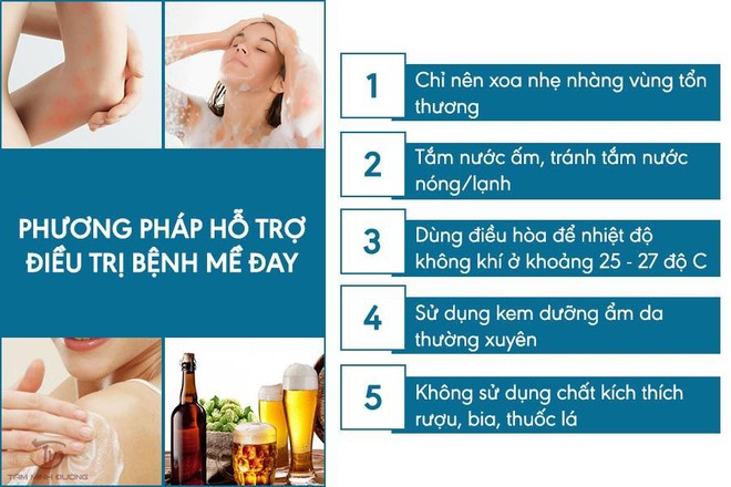 Bệnh nổi mề đay là gì? Nguyên nhân, triệu chứng và cách chữa hiệu quả - Ảnh 3.