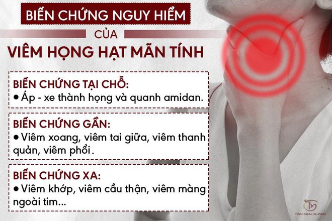 Viêm họng hạt là gì? Nguyên nhân, dấu hiệu và cách chữa trị - Ảnh 1.