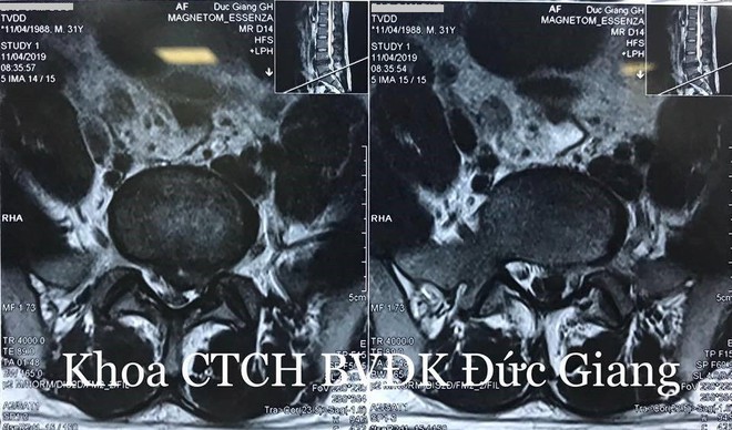 Đột nhiên không đi vệ sinh được, người đàn ông đi khám mới biết lý do bất ngờ - Ảnh 1.